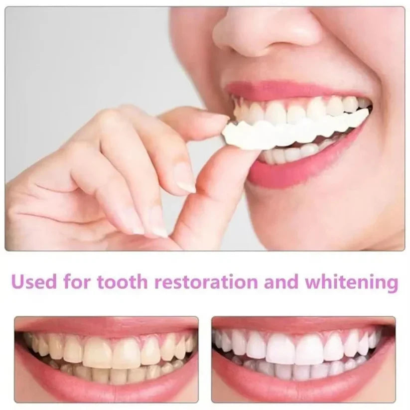 Snap on Smile Teeth Whitening veneers (Perfect Smile)