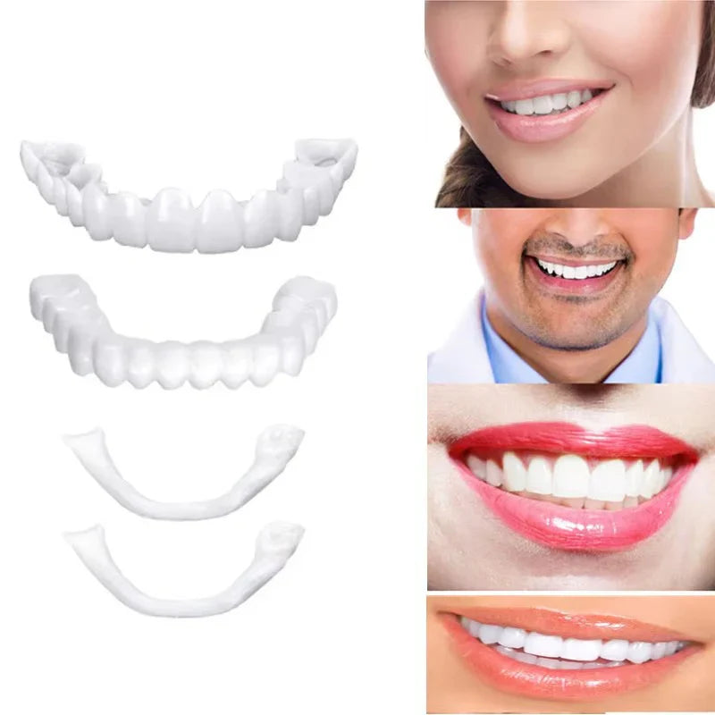 Snap on Smile Teeth Whitening veneers (Perfect Smile)