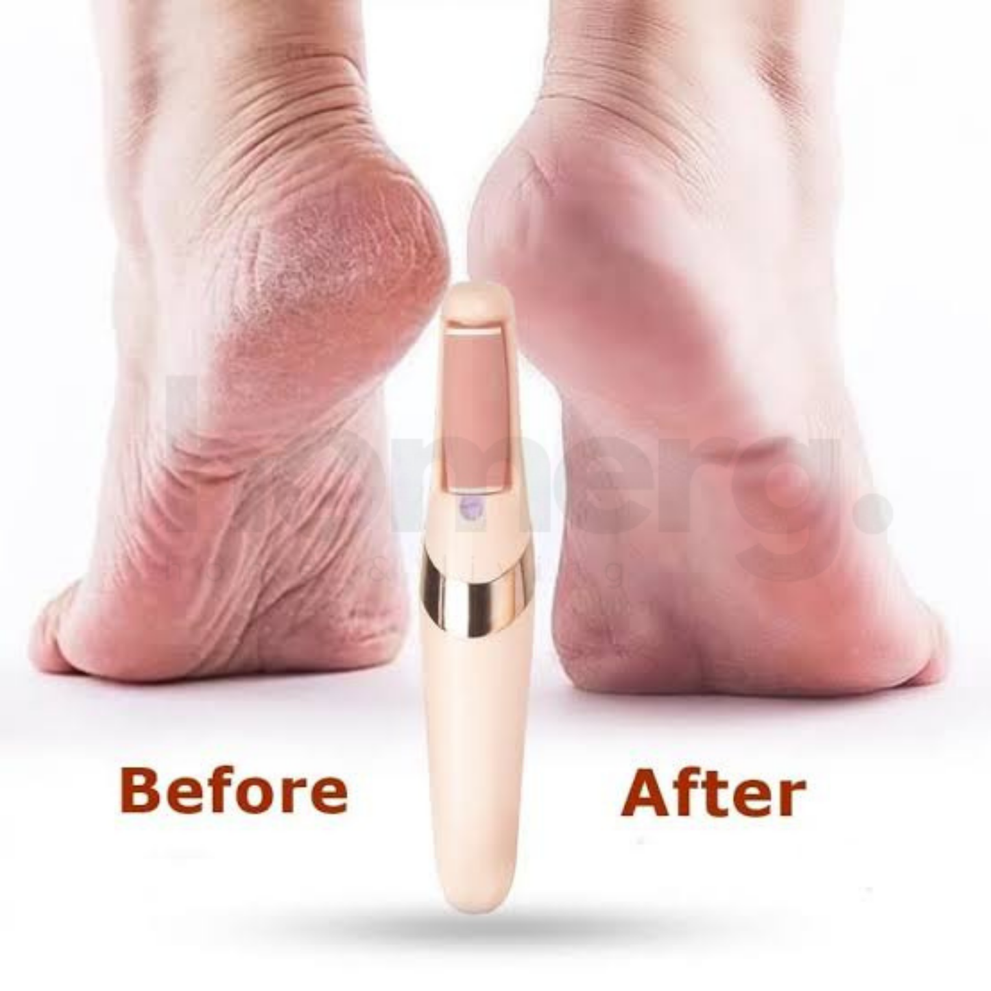 Flawless Pedi Foot Pedicure & Callus Remover