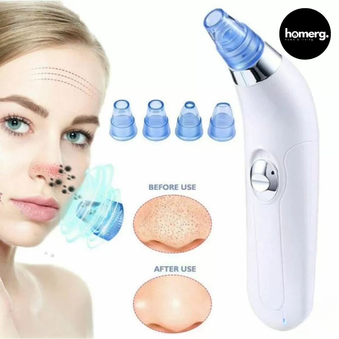 Derma Suction Blackhead & Pore Remover Device