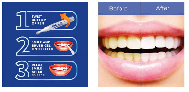 Teeth Whitening Pen Tool