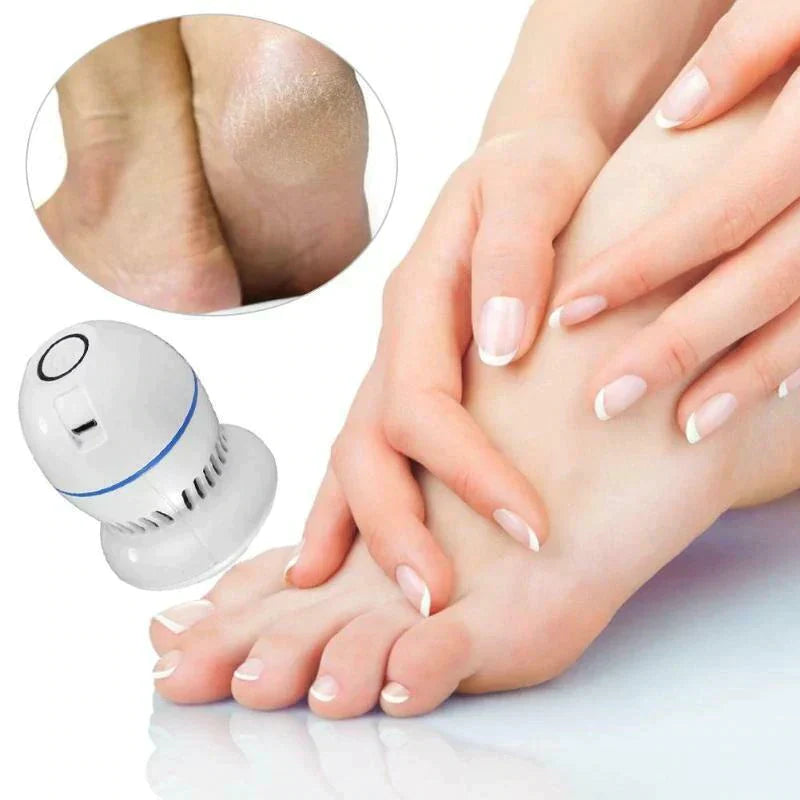 Electric Vacuum Foot Grinder & Callus Remover