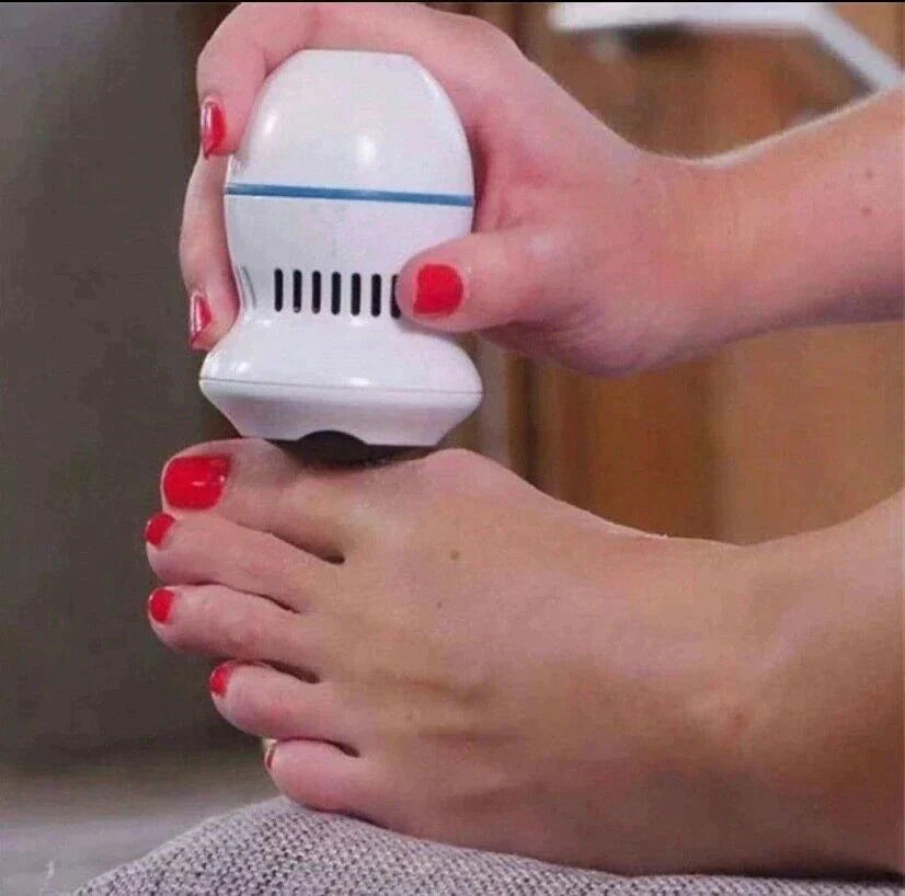 Electric Vacuum Foot Grinder & Callus Remover